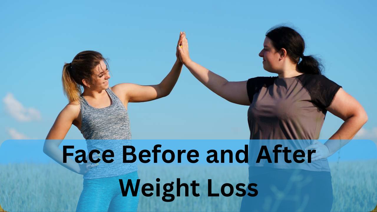 Face Before and After Weight Loss
